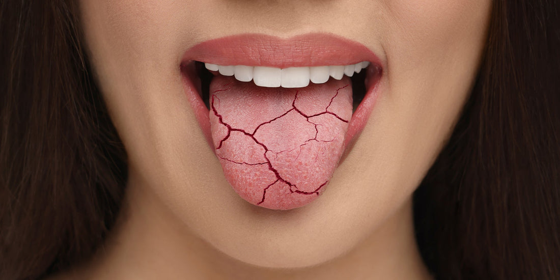 Dry Mouth: Causes, Symptoms, and Home Remedies
