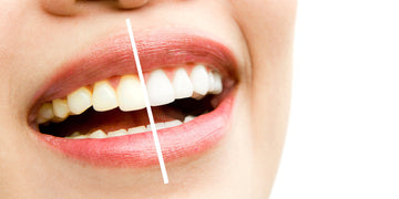 Natural Ways to Whiten Your Teeth Without Chemicals