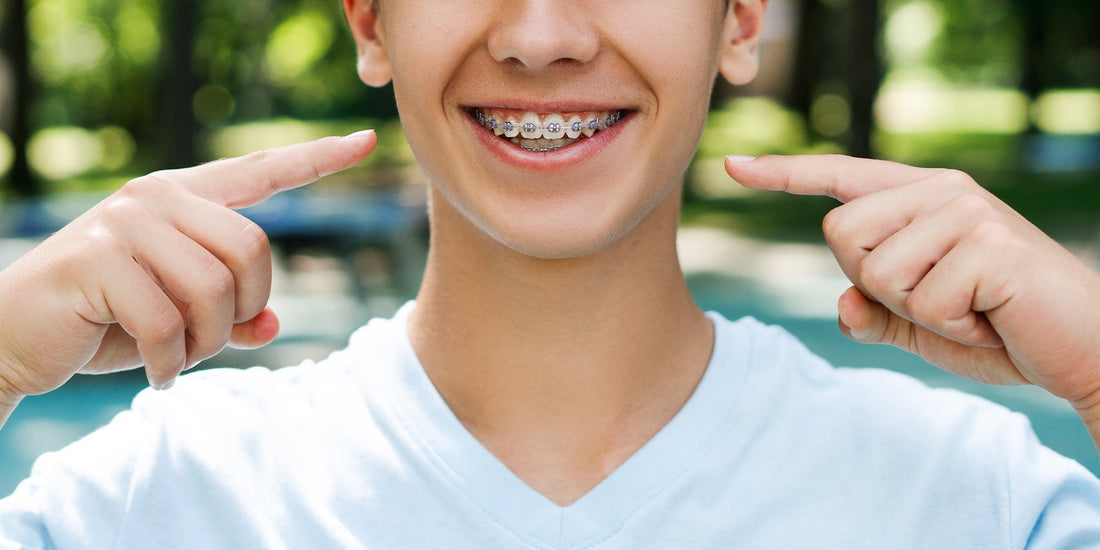 The Best Oral Care Routine for People with Braces