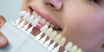 Professional Teeth Whitening vs. At-Home Kits: Pros & Cons