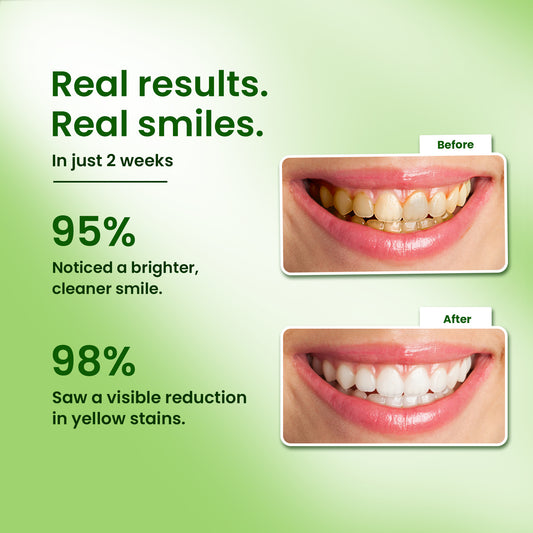 Hydroxyapatite,Sensitivity,Freshness