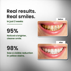  Hydroxyapatite, Whitening, Sensitivity 